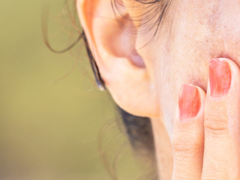 woman with red nails touching the brown spots on her cheek (model)